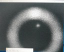 The first fluorescence from the 2D ytterbium MOT